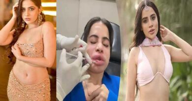 The beauty treatment that ended in disaster.. The actress faced tragedy!